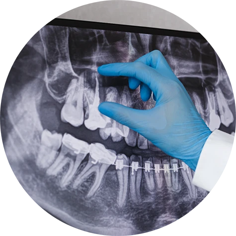 Digital X-Rays