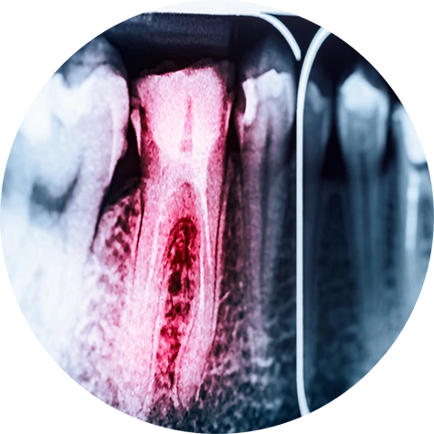 What Should I Do First in a Dental Emergency?
