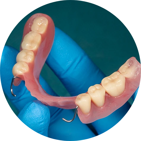 Are Partial Dentures Right for Me?