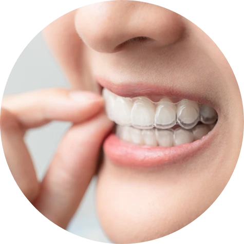 How Does Teeth Whitening Work?