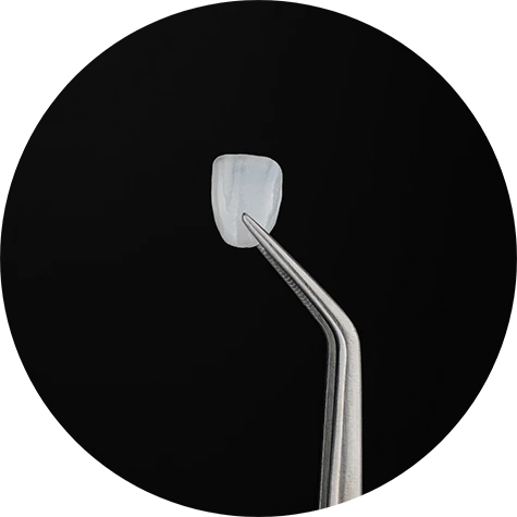 How Do Veneers Work?